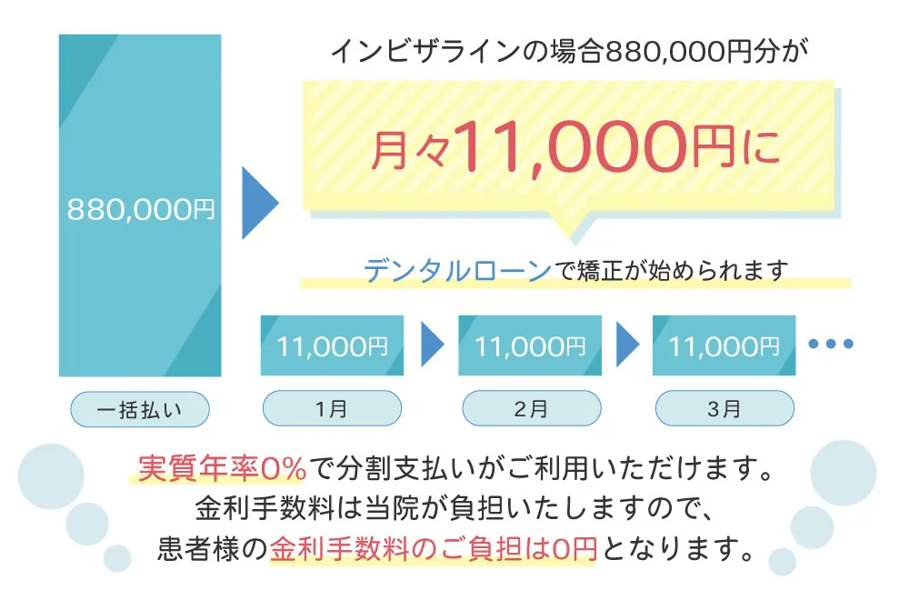 デンタルローンのご案内 分割払い対応